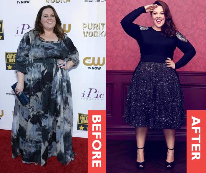 Fat, Thin, Skinny: How Did Melissa McCarthy Lose Weight? Weight Loss Surgery?